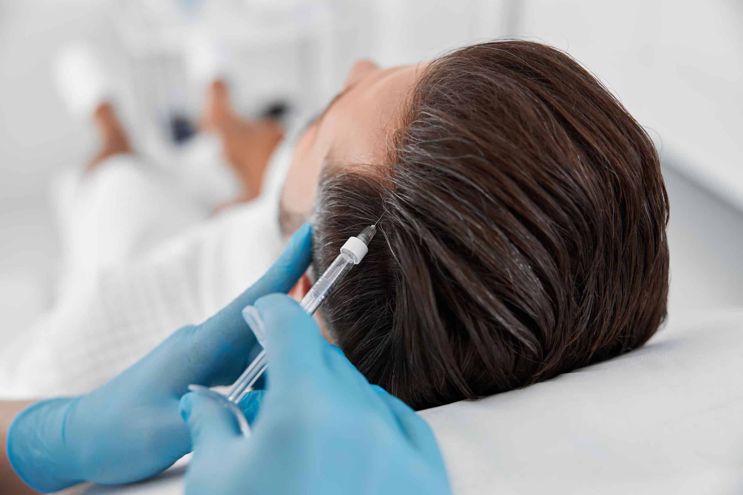 Stem Cell Hair Treatment